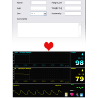 Παλμικό Οξύμετρο Καρπού με Λογισμικό Contec CMS50F