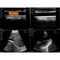Ασύρματος Διαγνωστικός Υπέρηχος Convex 3.5/5.0MHz & Linear 7.5/10.0MHz Sonostar White