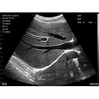 Ασύρματος Διαγνωστικός Υπέρηχος Convex 3.5/5.0MHz & Linear 7.5/10.0MHz Sonostar White