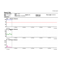 Παλμικό Οξύμετρο Καρπού με Λογισμικό Contec CMS50F