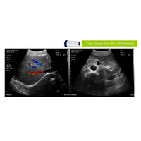 Ασύρματος Διαγνωστικός Υπέρηχος Sonostar 3.5-5.0MHz Convex Probe Color Doppler