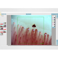 Τριχοειδοσκόπιο Inspectis CAP-2, με Λογισμικό CAP PRO Capillaroscopy