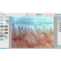 Τριχοειδοσκόπιο Inspectis CAP-2, με Λογισμικό CAP PRO Capillaroscopy