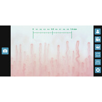 Τριχοειδοσκόπιο Inspectis CapiScope, WinCap Basics Software & Android