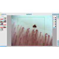Τριχοειδοσκόπιο Inspectis CapiScope, WinCap Basics Software & Android