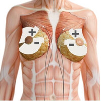 Αυτοκόλλητα Ηλεκτρόδια Φυσικοθεραπείας Στήθους TENS 60x130mm Tenscare | 4τμχ