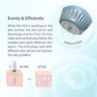 Συσκευή Μεσοθεραπείας Bio Needle H24