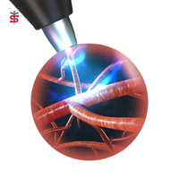 Συσκευή Θεραπείας Στυτικής Δυσλειτουργίας με Κρουστικά Κύματα (Shock Wave Therapy) Oceanus EDX