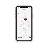 Δερματοσκόπιο Heine DELTAone Λευκό