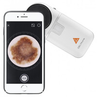 Δερματοσκόπιο Heine DELTAone Λευκό