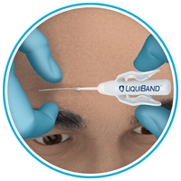 Τοπικό  Δερματικό  Συγκολλητικό  LiquiBand® Optima | 1τμχ