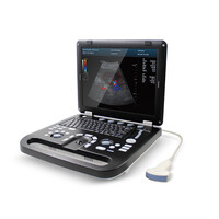 Έγχρωμος Φορητός Υπέρηχος Doppler CONTEC CMS1700C | Convex Array Probe 3.5MHz