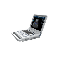 Έγχρωμος Φορητός Υπέρηχος Doppler CONTEC CMS1700B | Convex Array Probe 3.5MHz