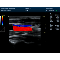 Έγχρωμος Φορητός Υπέρηχος Doppler CONTEC CMS1700B | Convex Array Probe 3.5MHz