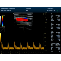 Έγχρωμος Φορητός Υπέρηχος Doppler CONTEC CMS1700B | Convex Array Probe 3.5MHz