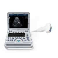 Έγχρωμος Φορητός Υπέρηχος Doppler CONTEC CMS1700B | Convex Array Probe 3.5MHz