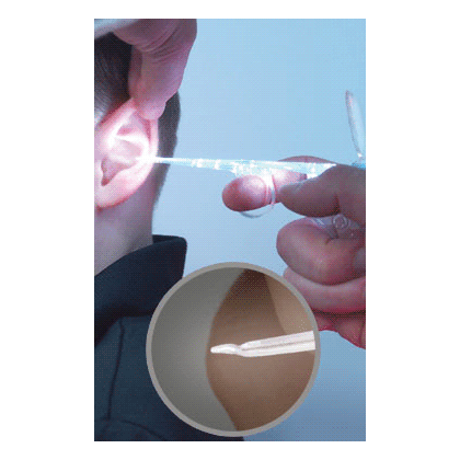 Φωτιζόμενες Κιουρέτες Αυτιών Bionix® Αρθρωτού Άκρου