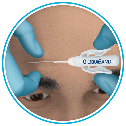 Τοπικό  Δερματικό  Συγκολλητικό  LiquiBand® Optima | 1τμχ