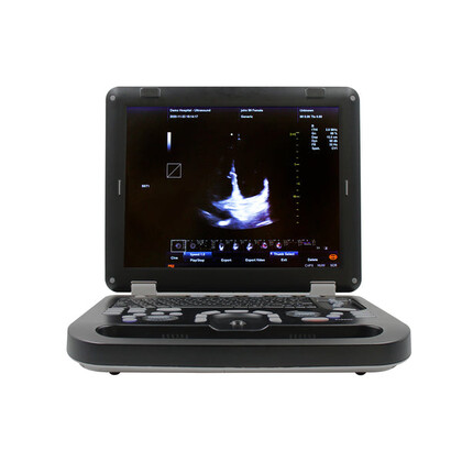 Έγχρωμος Φορητός Υπέρηχος Doppler CONTEC CMS1700C | Convex Array Probe 3.5MHz