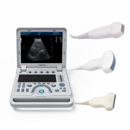 Έγχρωμος Φορητός Υπέρηχος Doppler CONTEC CMS1700B | Convex Array Probe 3.5MHz