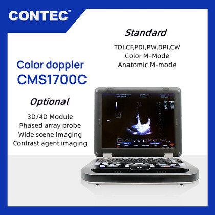Έγχρωμος Φορητός Υπέρηχος Doppler CONTEC CMS1700C | Convex Array Probe 3.5MHz