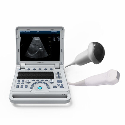 Έγχρωμος Φορητός Υπέρηχος Doppler CONTEC CMS1700B | Convex Array Probe 3.5MHz