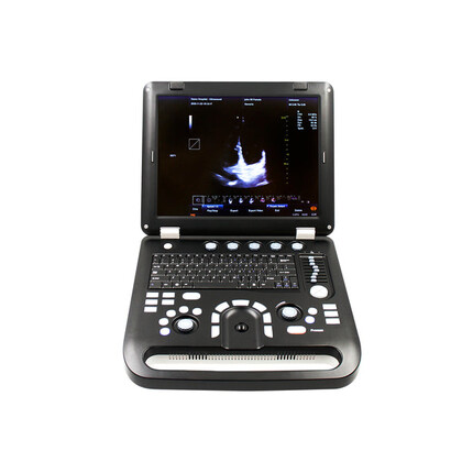 Έγχρωμος Φορητός Υπέρηχος Doppler CONTEC CMS1700C | Convex Array Probe 3.5MHz