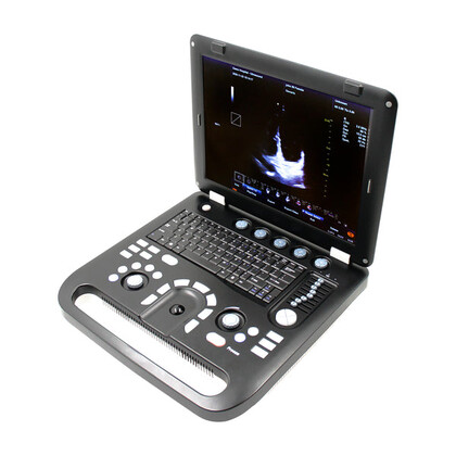 Έγχρωμος Φορητός Υπέρηχος Doppler CONTEC CMS1700C | Convex Array Probe 3.5MHz