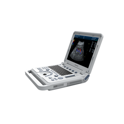 Έγχρωμος Φορητός Υπέρηχος Doppler CONTEC CMS1700B | Convex Array Probe 3.5MHz