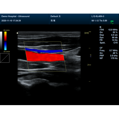 Έγχρωμος Φορητός Υπέρηχος Doppler CONTEC CMS1700C | Convex Array Probe 3.5MHz