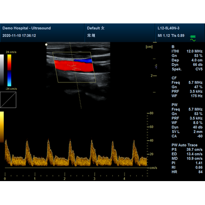 Έγχρωμος Φορητός Υπέρηχος Doppler CONTEC CMS1700C | Convex Array Probe 3.5MHz