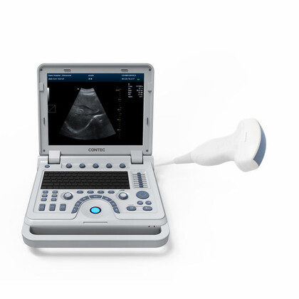 Έγχρωμος Φορητός Υπέρηχος Doppler CONTEC CMS1700B | Convex Array Probe 3.5MHz
