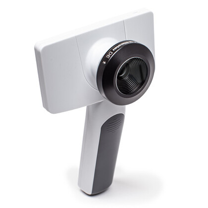 Riester RCS-100 Ψηφιακό Δερματοσκόπιο HD & Ιατρική Κάμερα Τηλεϊατρικής