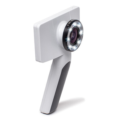 Riester RCS-100 Ψηφιακή Ιατρική Κάμερα με Φακό Γενικής Χρήσης