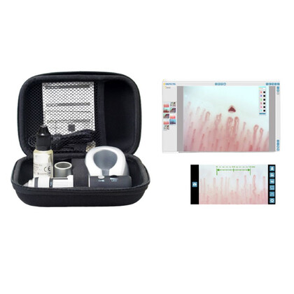 DigiScope Wi-Fi System Lite DM-110 Ψηφιακό Τριχοειδοσκόπιο Inspectis | APP Android & iOS
