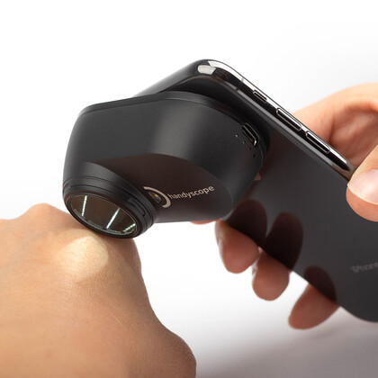 Ψηφιακό Δερματοσκόπιο Smartphone DermLite handyscope 10x